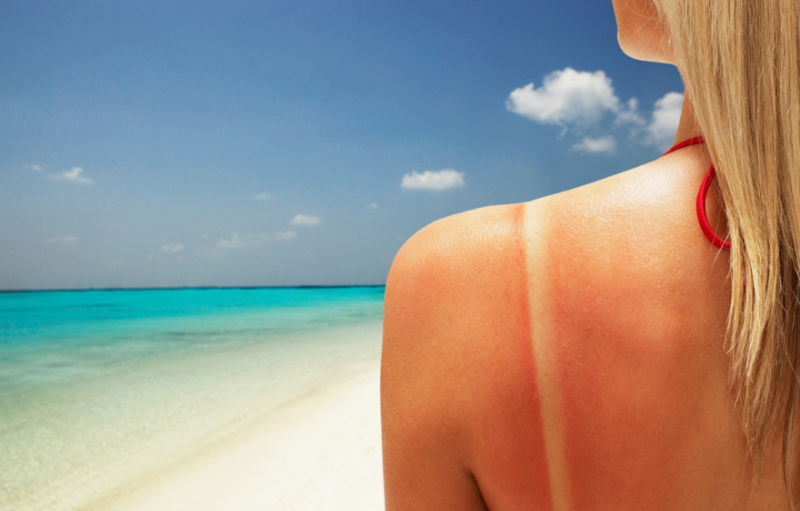 How to care for the skin after sun exposure?